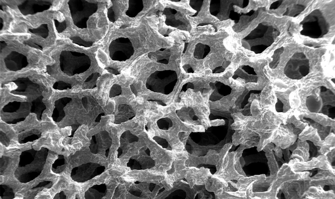 Projektbeispiel - finden von Märkten für Metallschäume